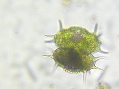 Xanthidium antilopaeum polymazum