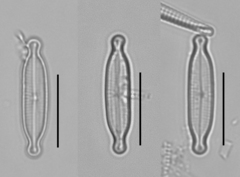 Encyonopsis microcephala