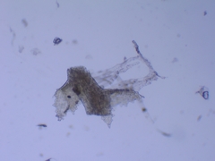 Cephaloziella turneri