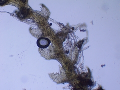 Cephaloziella turneri