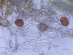 Golovinomyces montagnei