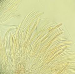 Ciboria shiraiana