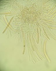 Ciboria shiraiana