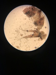 Trichoniscus pusillus