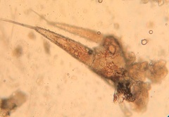 Trichoniscus pusillus