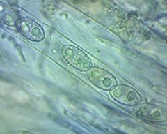 Daleomyces petersii