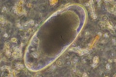 Nematodirus