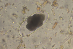 Nematodirus