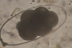 Nematodirus
