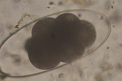Nematodirus