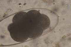 Nematodirus