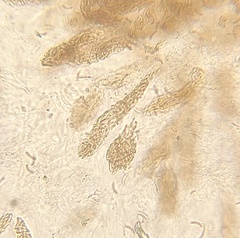 Cryptovalsa prominens