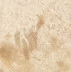 Cryptovalsa prominens