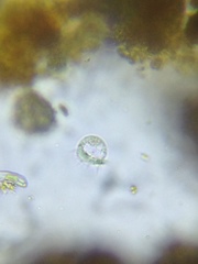 Strobilidium