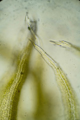 Racomitrium ericoides