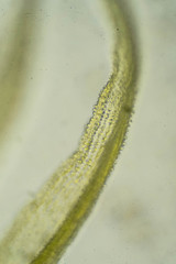 Racomitrium ericoides