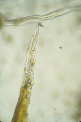 Racomitrium ericoides