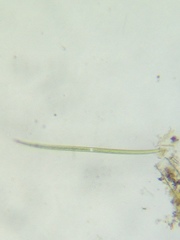 Closterium angustatum