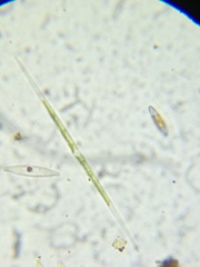Closterium aciculare