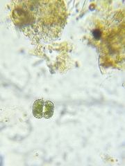 Cosmarium contractum