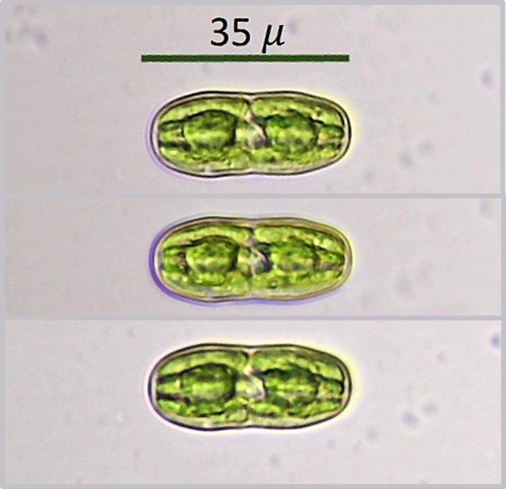 Actinotaenium
