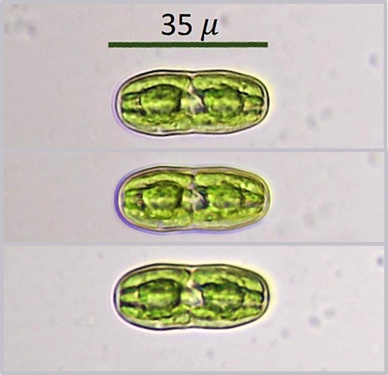 Actinotaenium