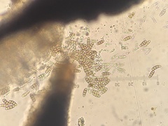 Hysterium hyalinum