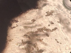Trematosphaeria crassiseptata