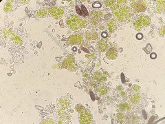 Bacidina egenuloidea