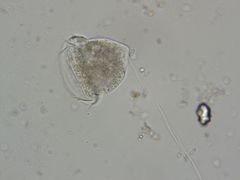 Vorticella campanula