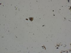 Vorticella campanula