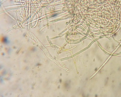 Parachnopeziza miniopsis