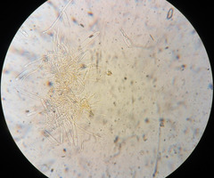 Parachnopeziza miniopsis