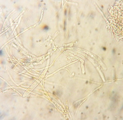 Parachnopeziza miniopsis