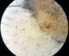 Parachnopeziza miniopsis