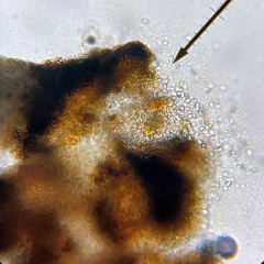 Abrothallus microspermus