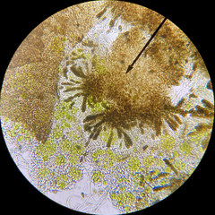 Abrothallus microspermus