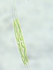 Closterium leibleinii