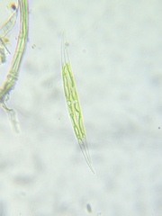 Closterium leibleinii
