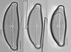 Encyonema leibleinii