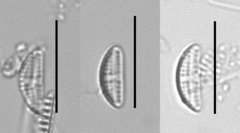 Amphora pediculus
