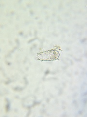 Euglypha acanthophora