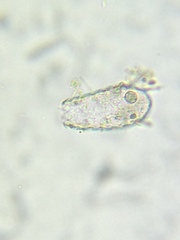 Euglypha acanthophora