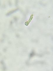 Astasia