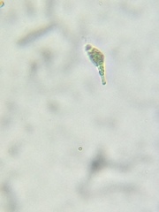 Astasia