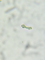 Astasia
