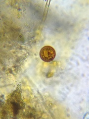 Trachelomonas cervicula