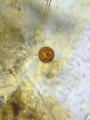 Trachelomonas cervicula