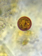 Trachelomonas cervicula