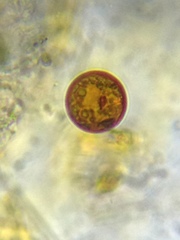 Trachelomonas cervicula